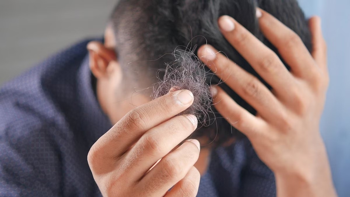 Hair Fall-Hair Loss